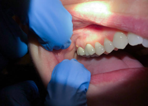 Best Emergency Denture Repair in Andusia, AL